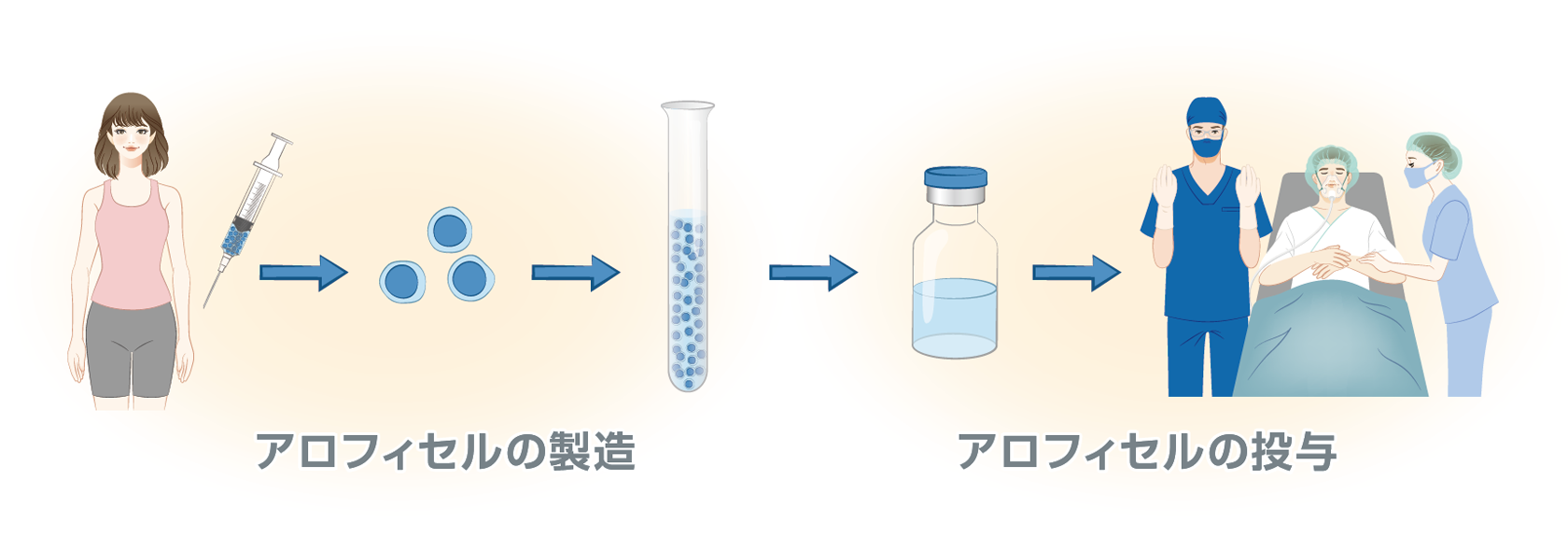 アロフィセルについて